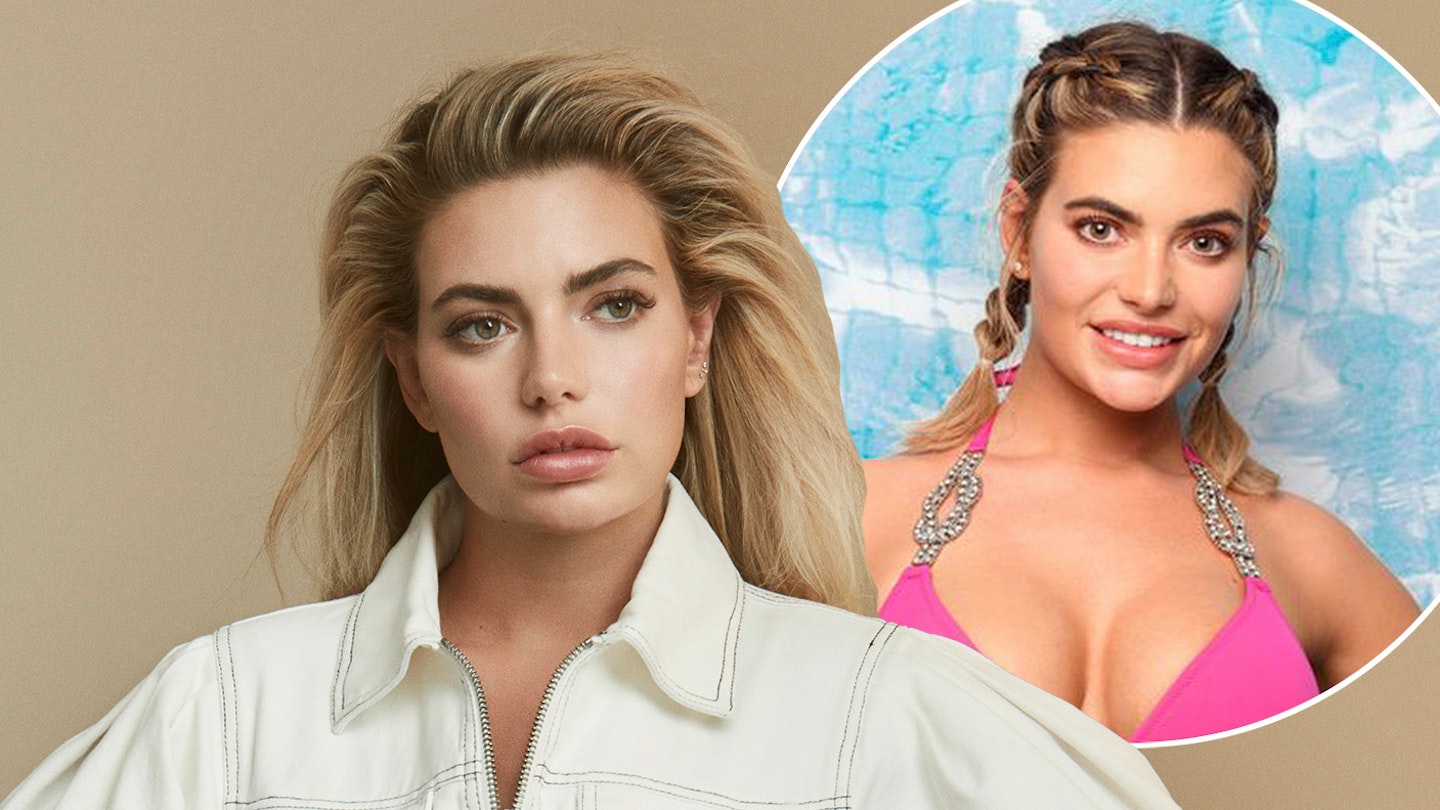 Love Island s Megan Barton Hanson Opens Up About Plastic Surgery love-island-s-megan-barton-hanson-opens-up-about-plastic-surgery
