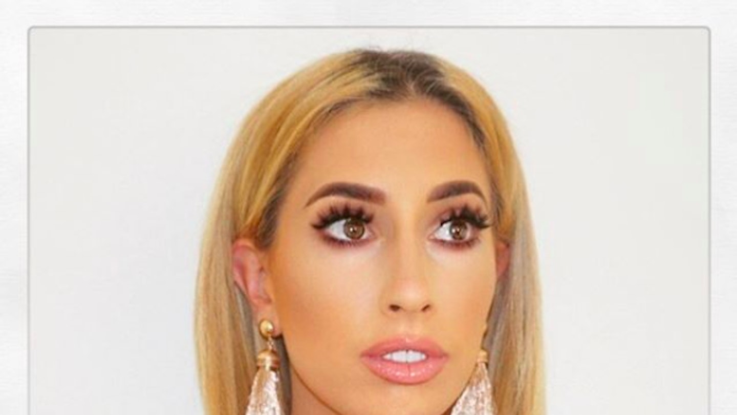 stacey solomon anal bleaching