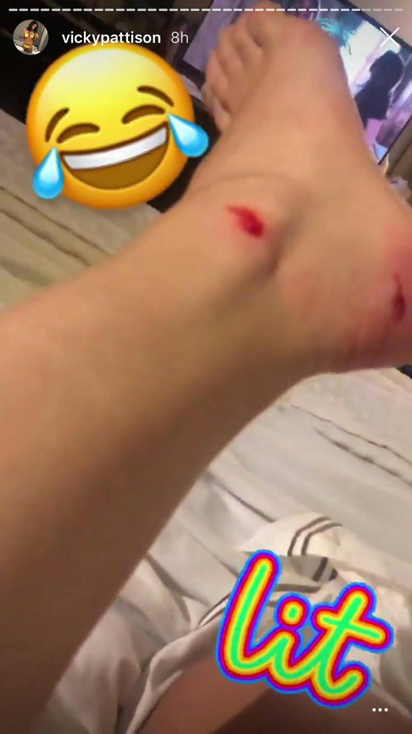 Vicky P injury