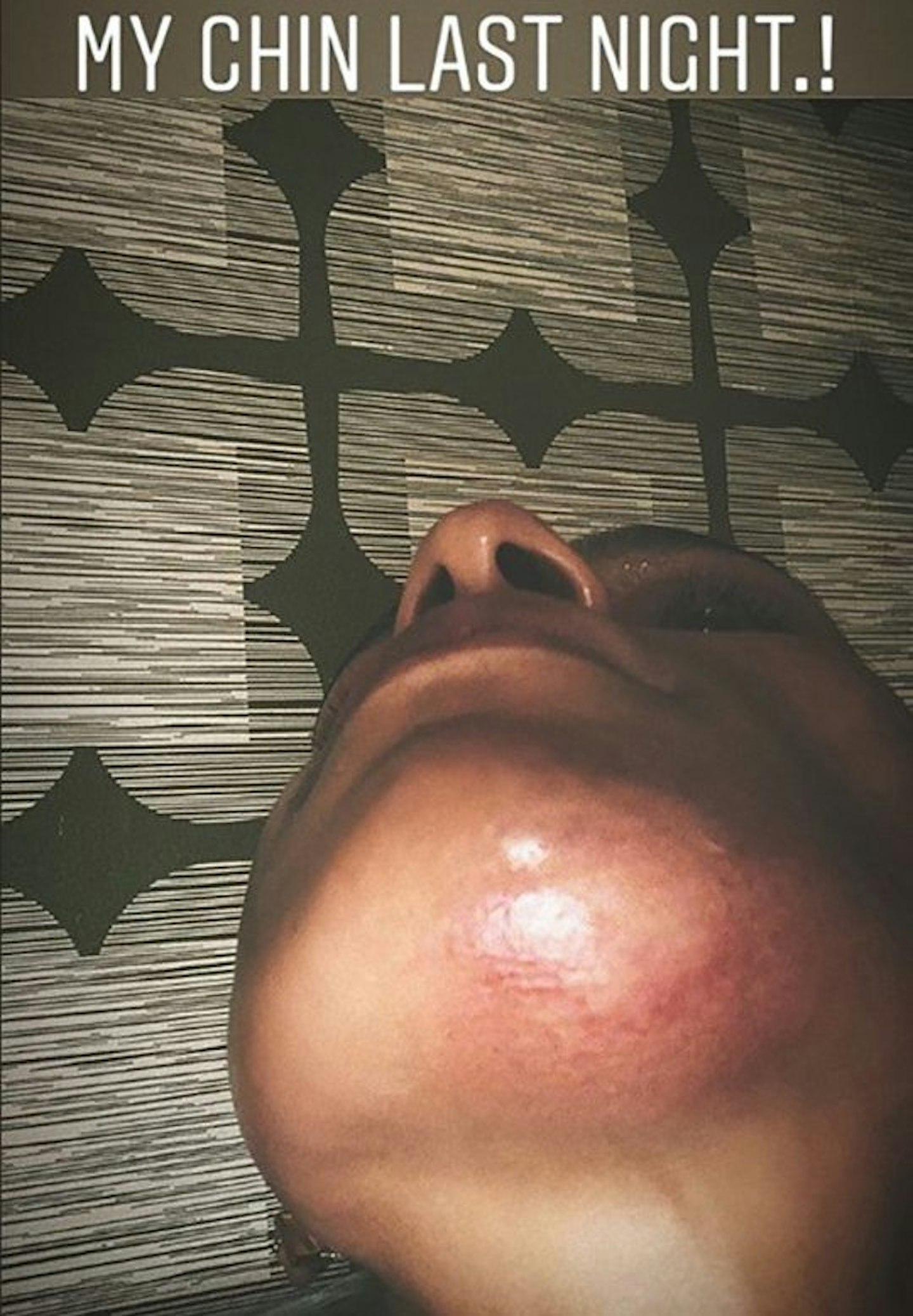 Melody Thornton injury Instagram story