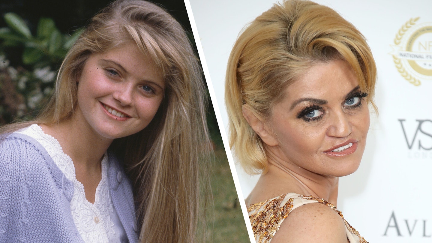 Eastenders' Danniella Westbrook: before and after face pictures