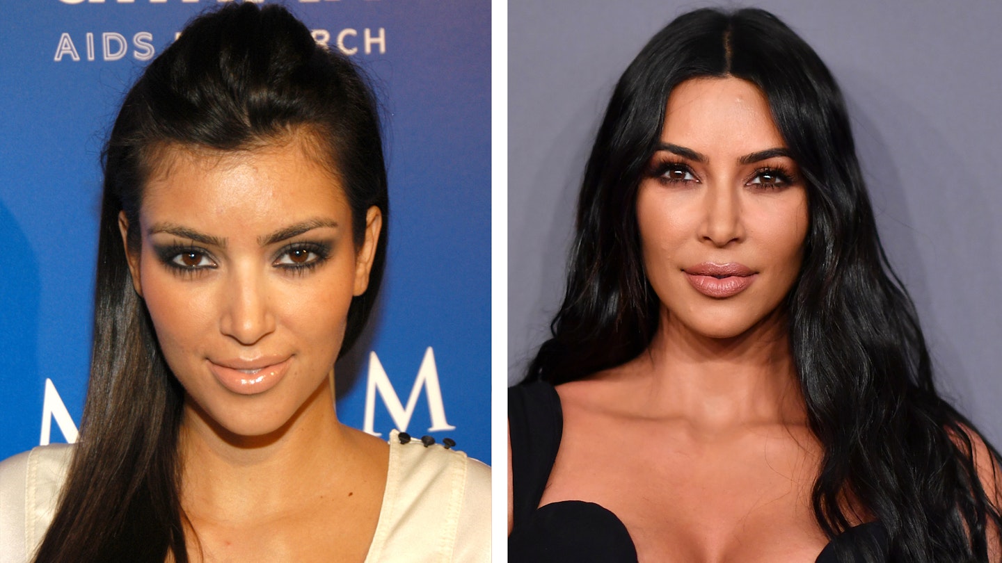 kim kardashian before after plastic surgery