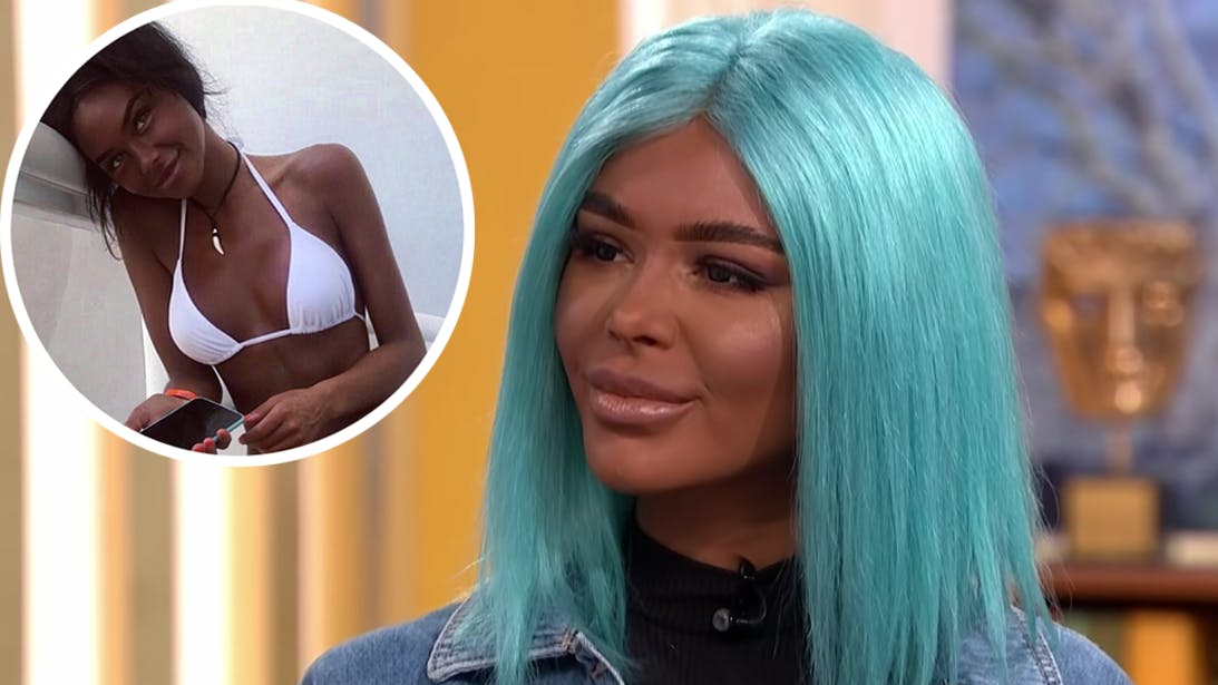 Tan Addict ‘Jabs and sunbeds could kill me but I won’t quit’ Closer