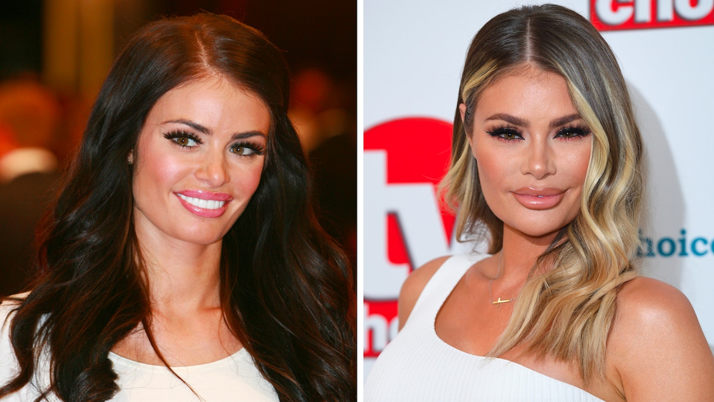 chloe sims plastic surgery before after towie
