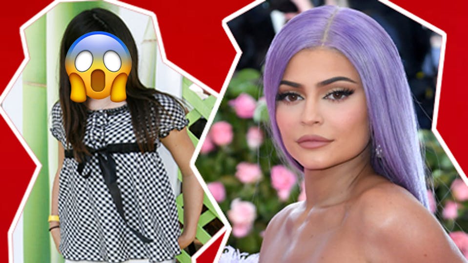 Kylie Jenner before and after plastic surgery | Celebrity | Heat