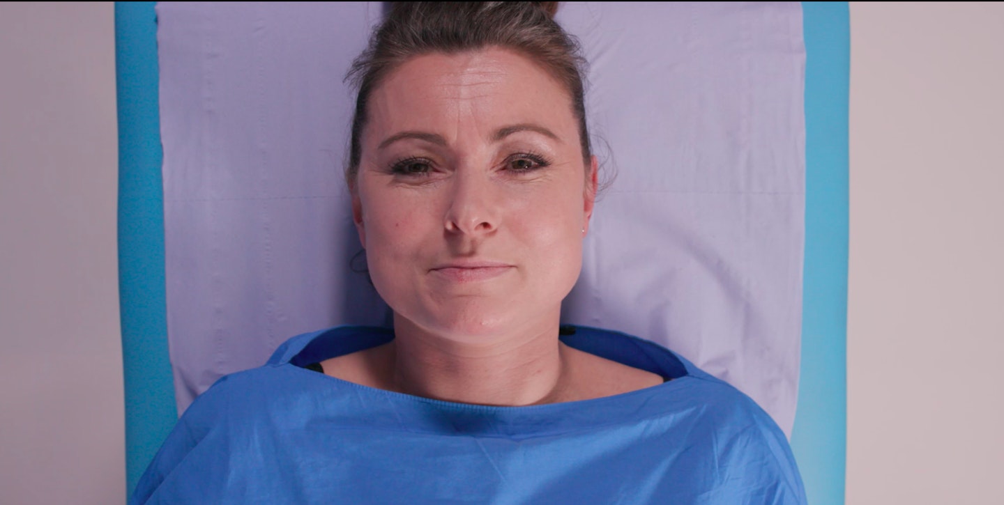 cervical screening