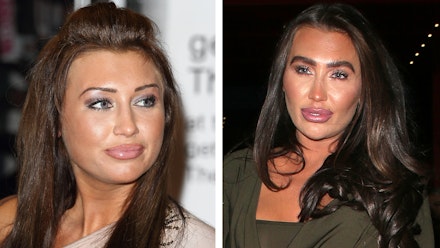 The heartbreak behind Lauren Goodger’s changing face Closer