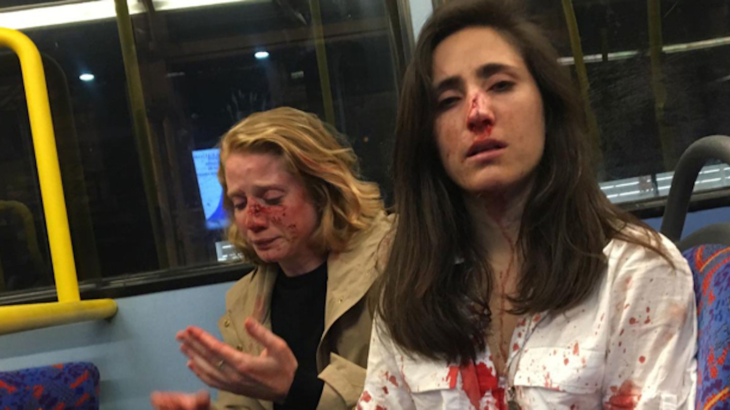 Melania Geymonat and her girlfriend Chris after they were attacked last night