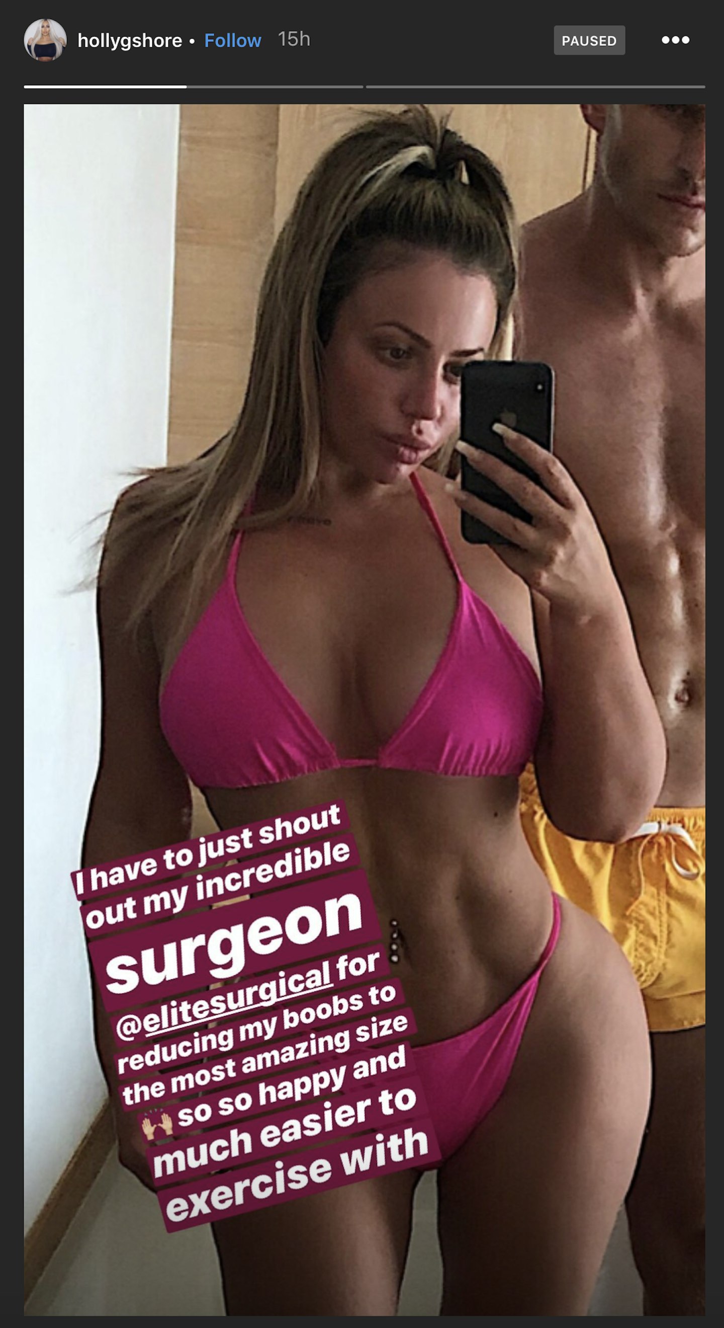 Geordie Shore's Holly Hagan shows off results of breast reduction