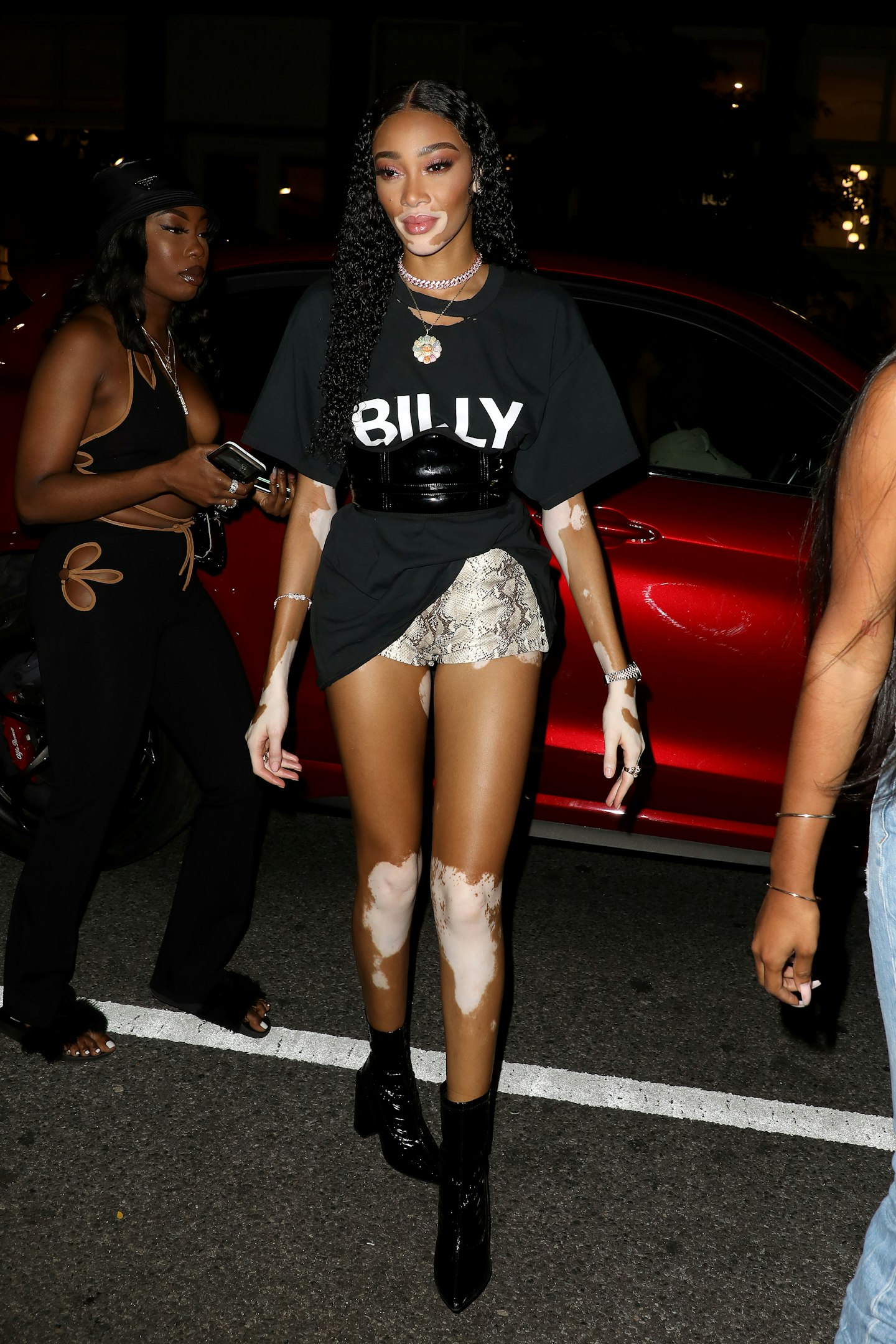 Winnie Harlow