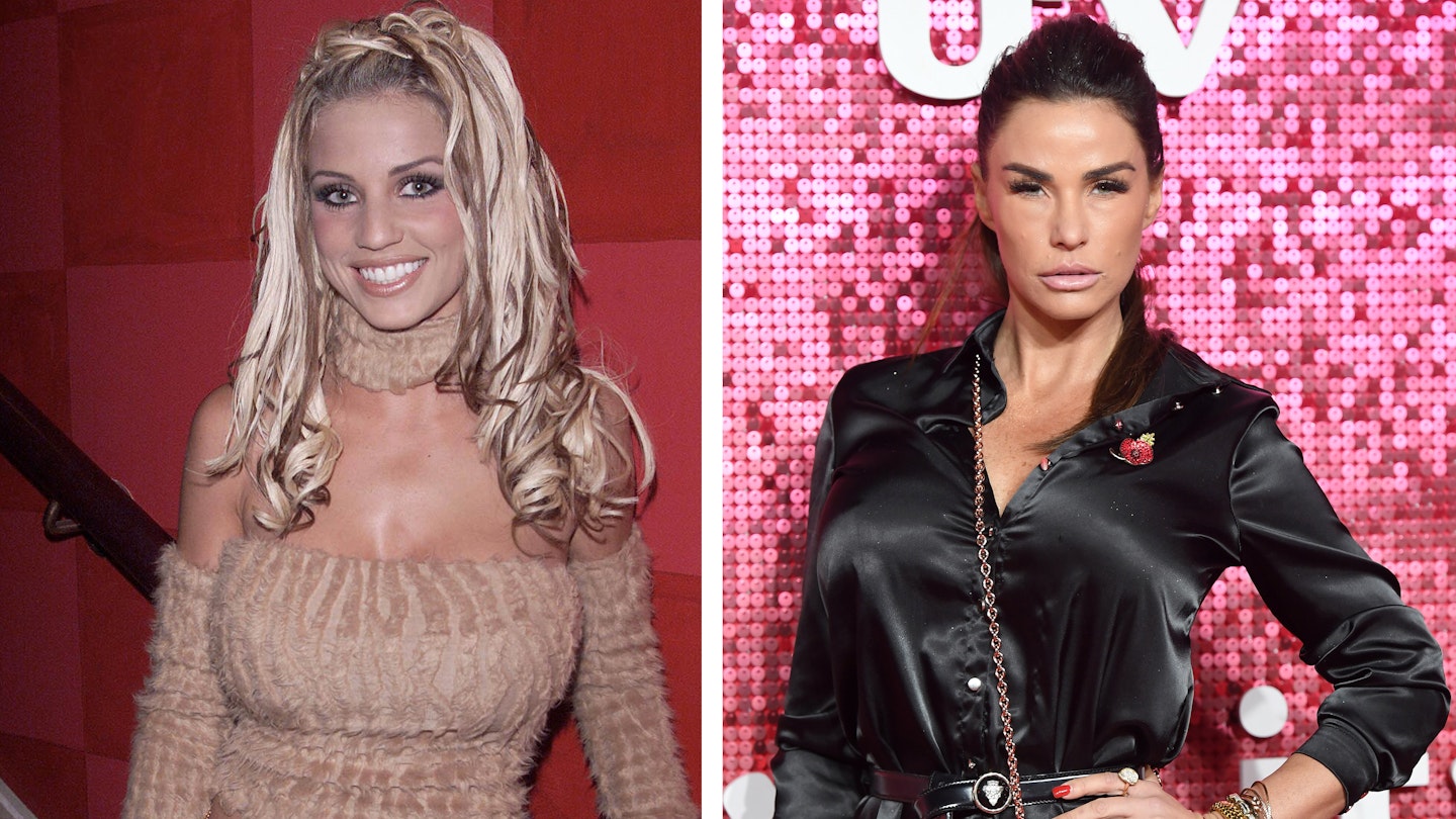 katie price before after surgery