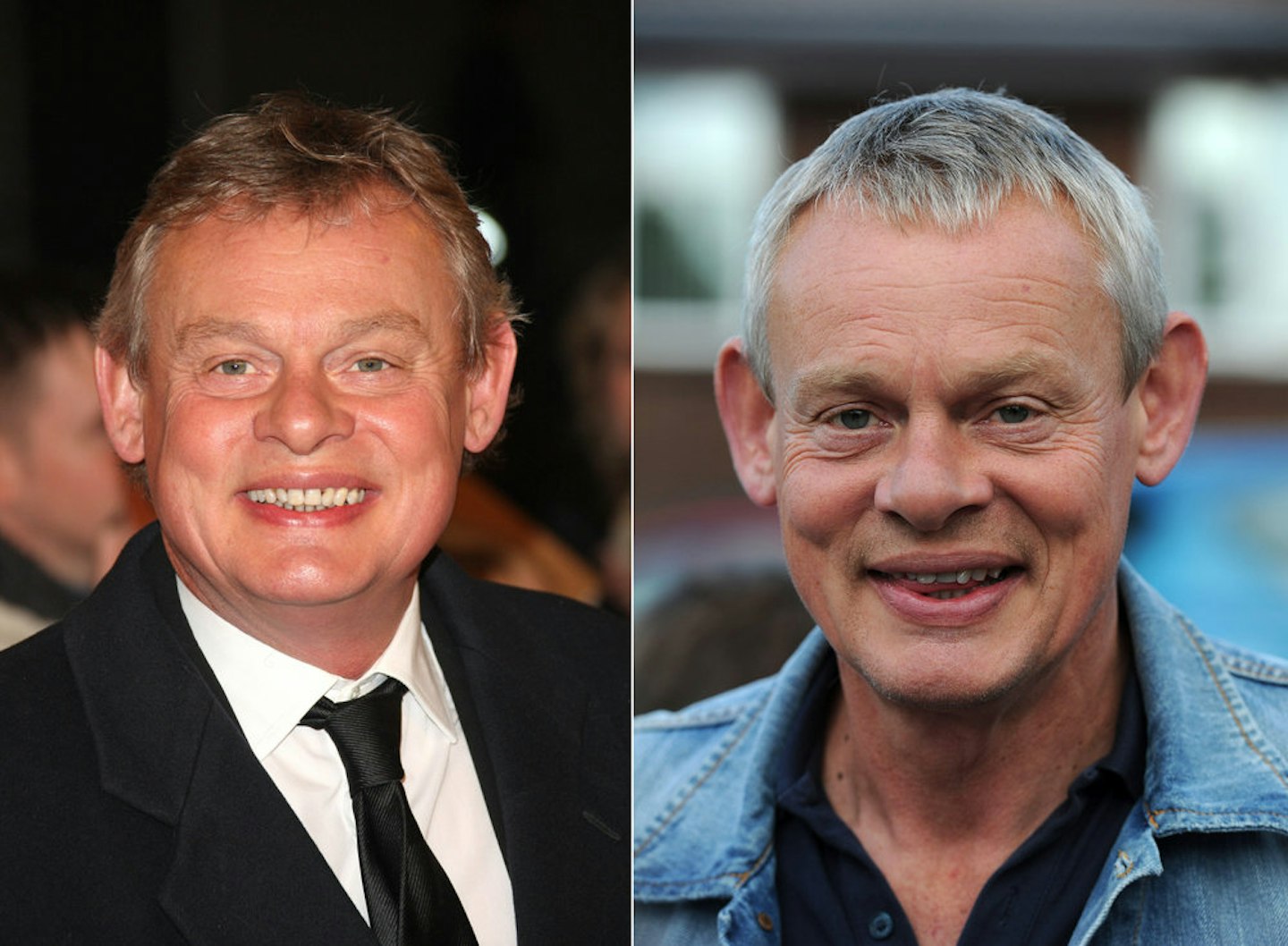 Martin Clunes Weight Loss