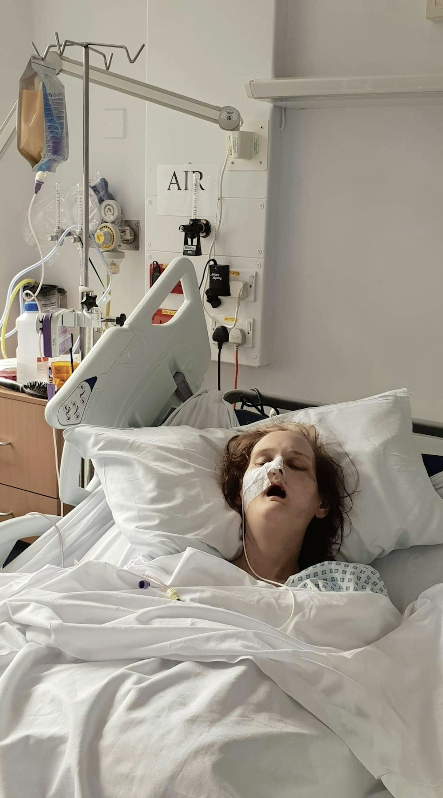 Malissa Jones induced coma