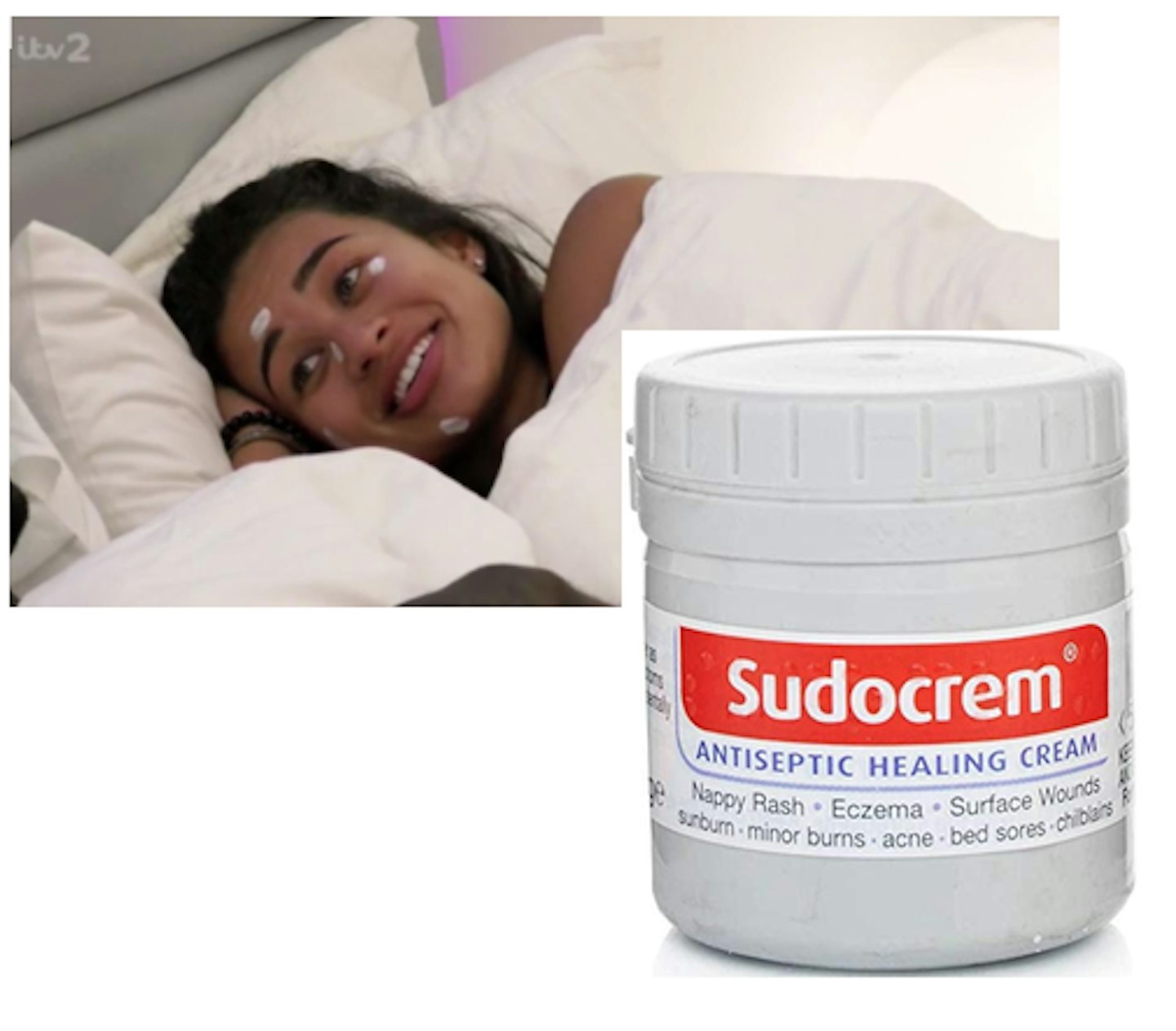 Sudocrem Is A Spot Solution To Consider