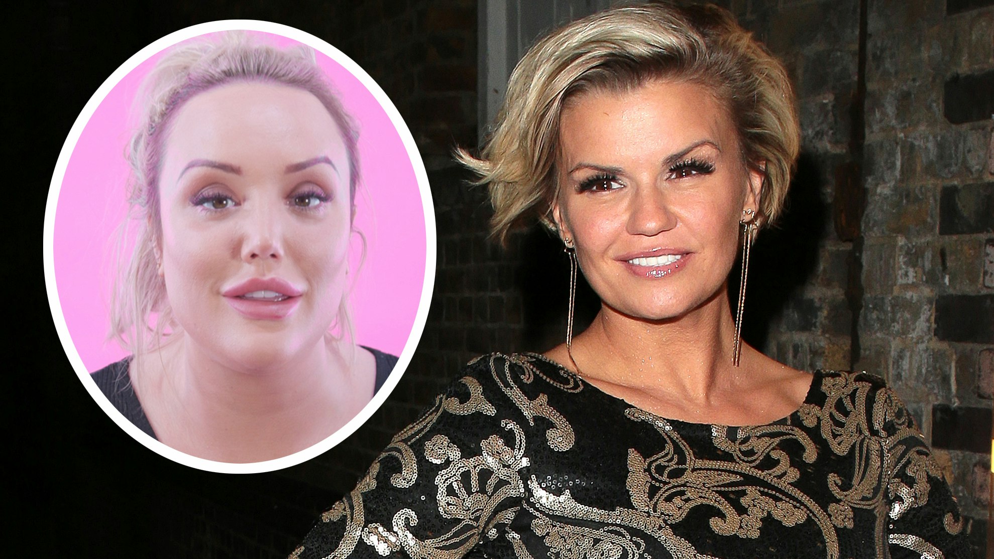 Kerry Katona shows off smaller boobs after having breast reduction