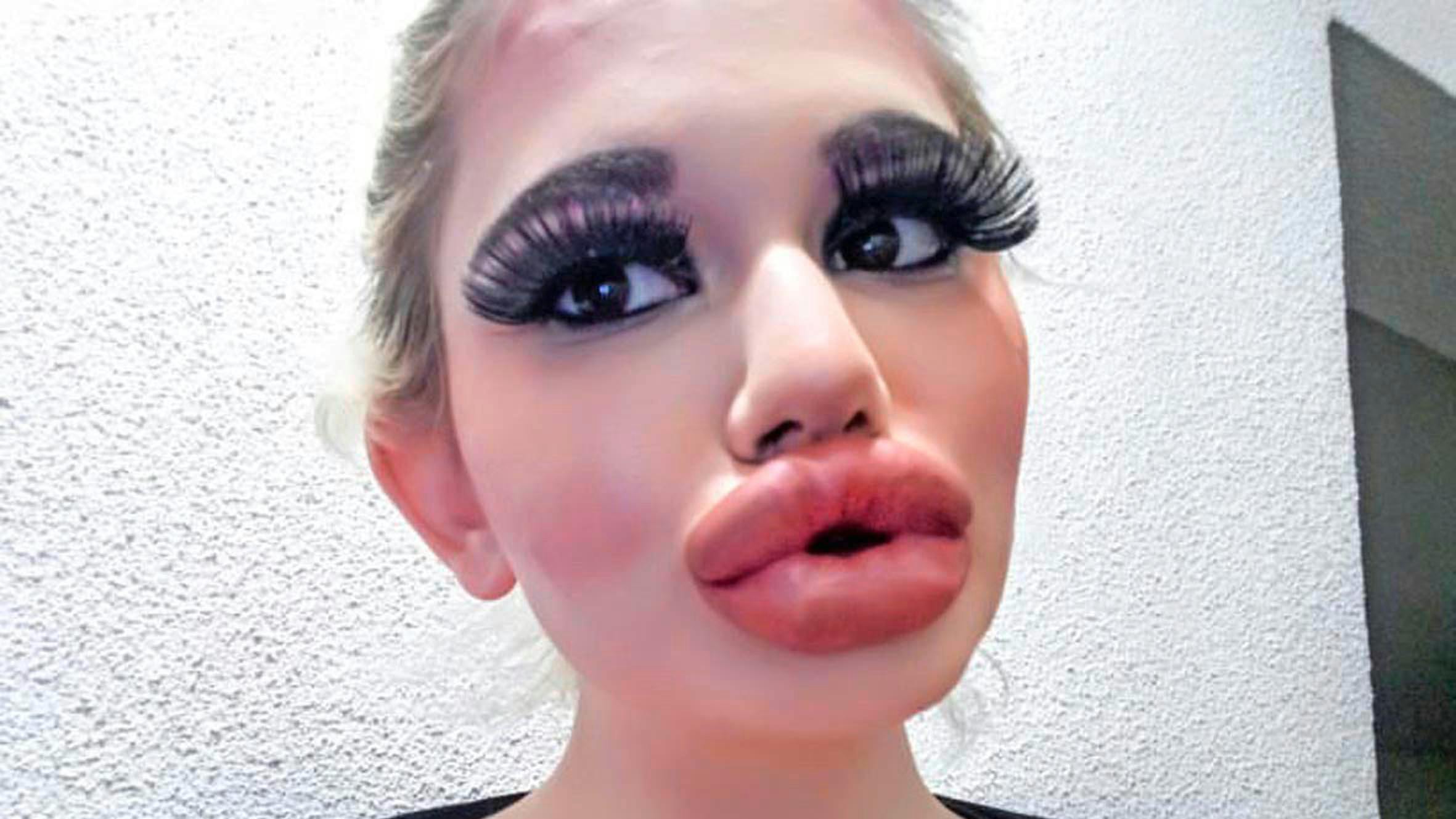 Instagram model I have the worlds biggest lips Real Life Closer