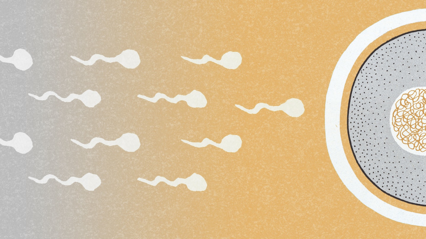 A study suggests sperm donations should be taken from the dead