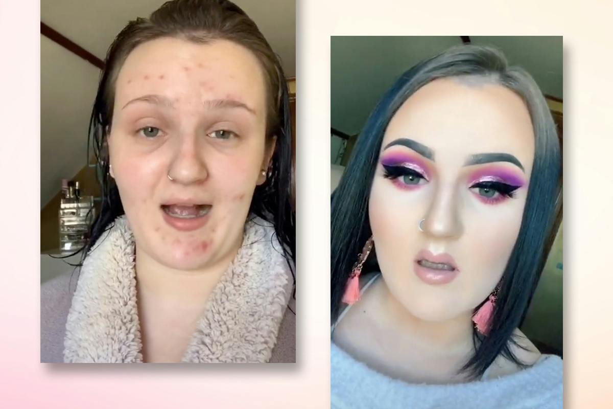 A TikTok acne concealing make-up hack has gone viral and it's GOOD