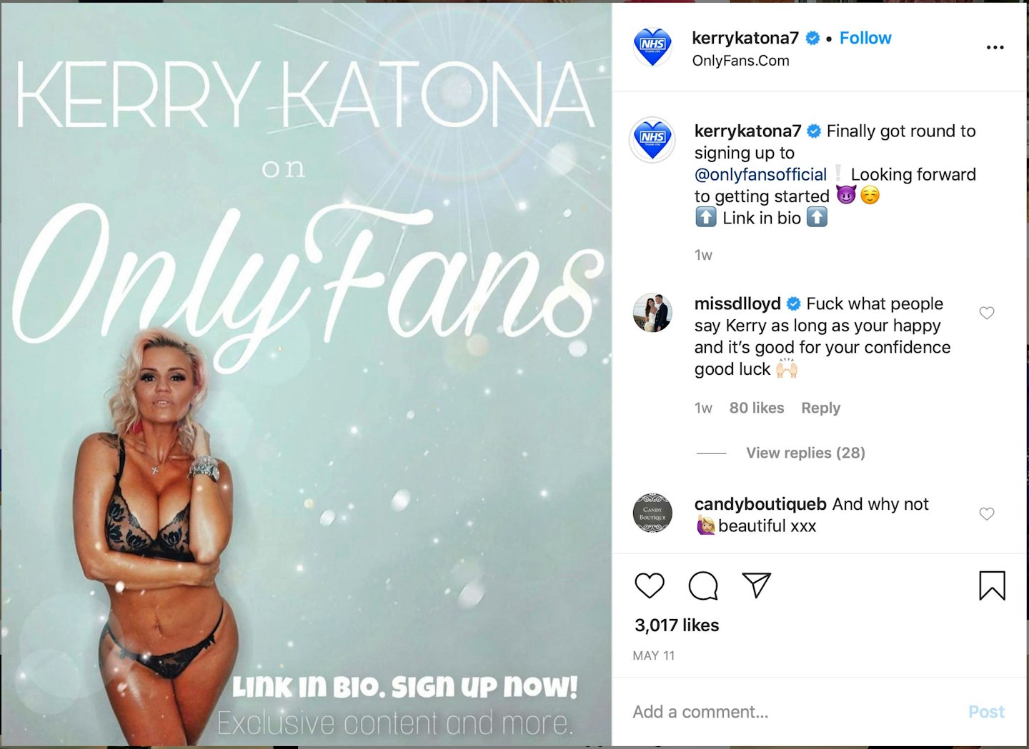 Kerry Katona Only Fans