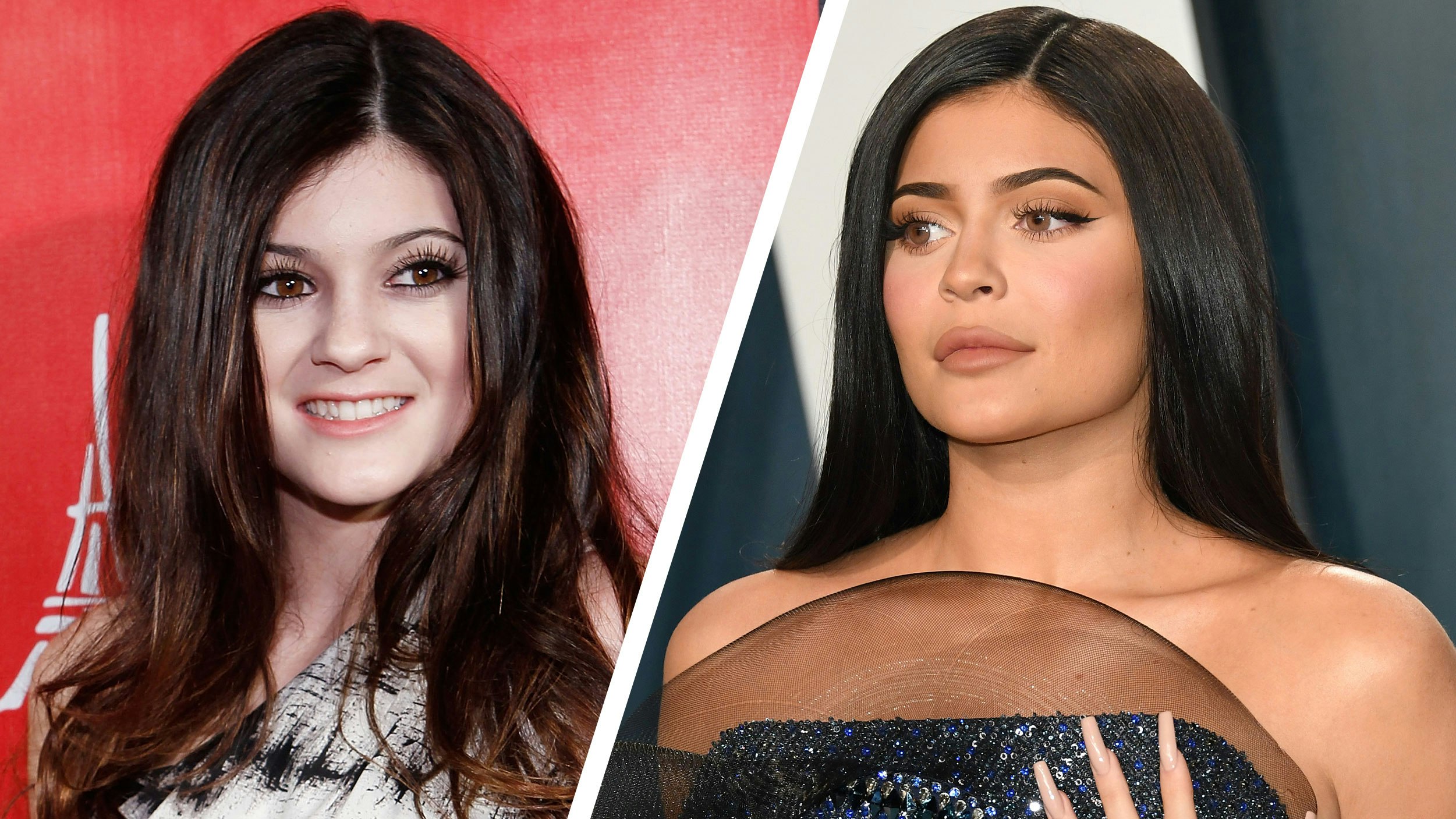 Kylie Jenner before and after: her jaw-dropping transformation pics
