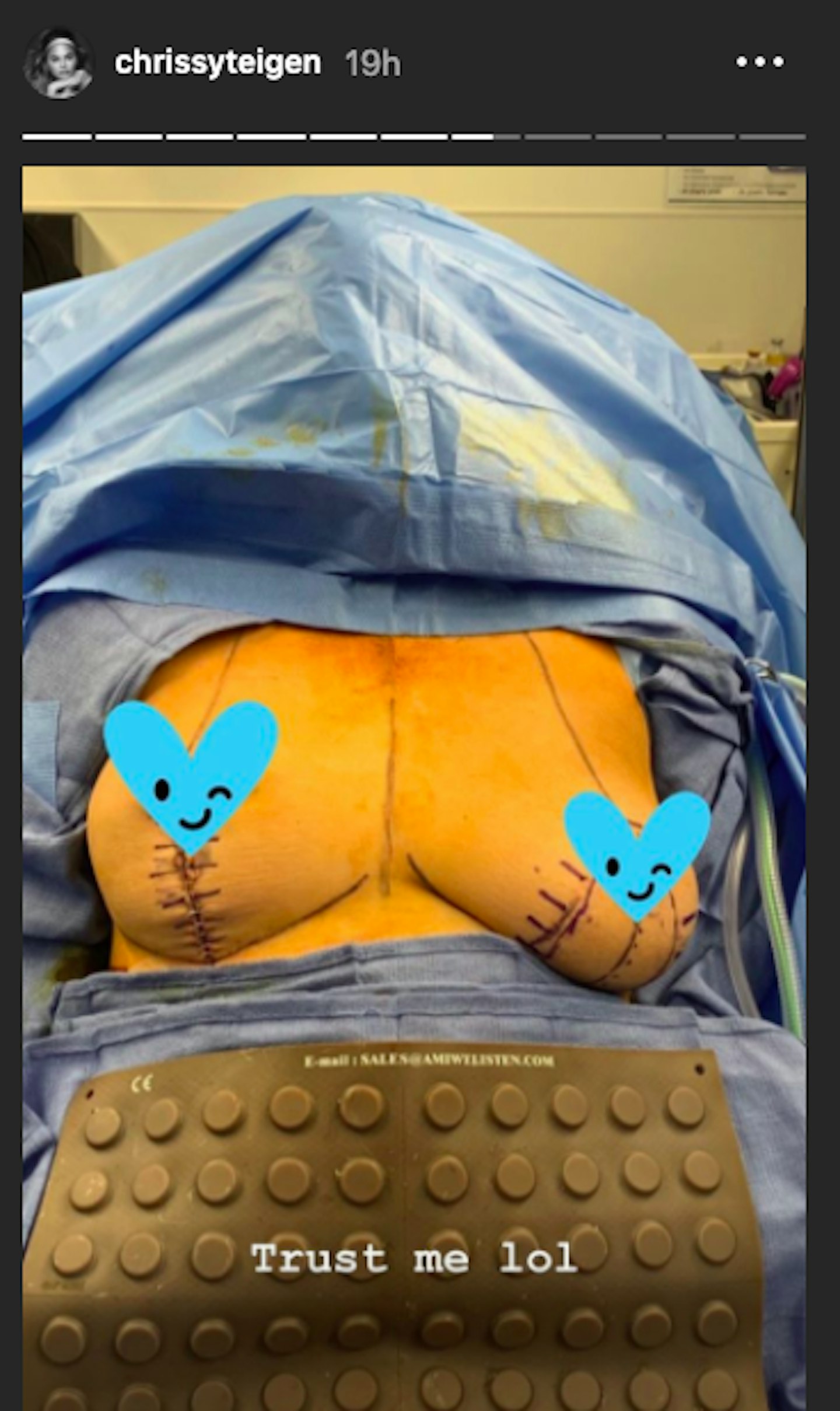 @chrissyteigen