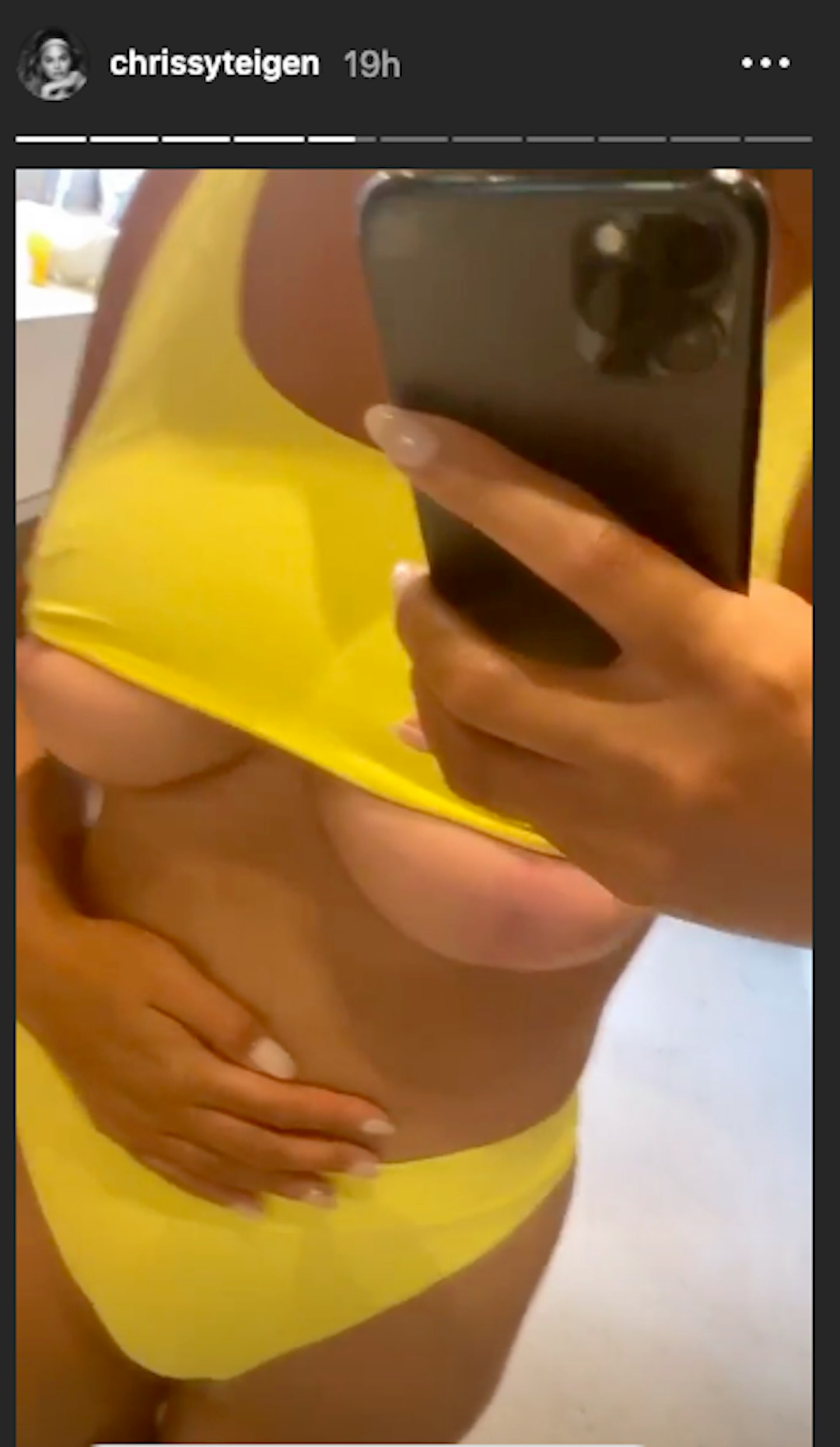 @chrissyteigen