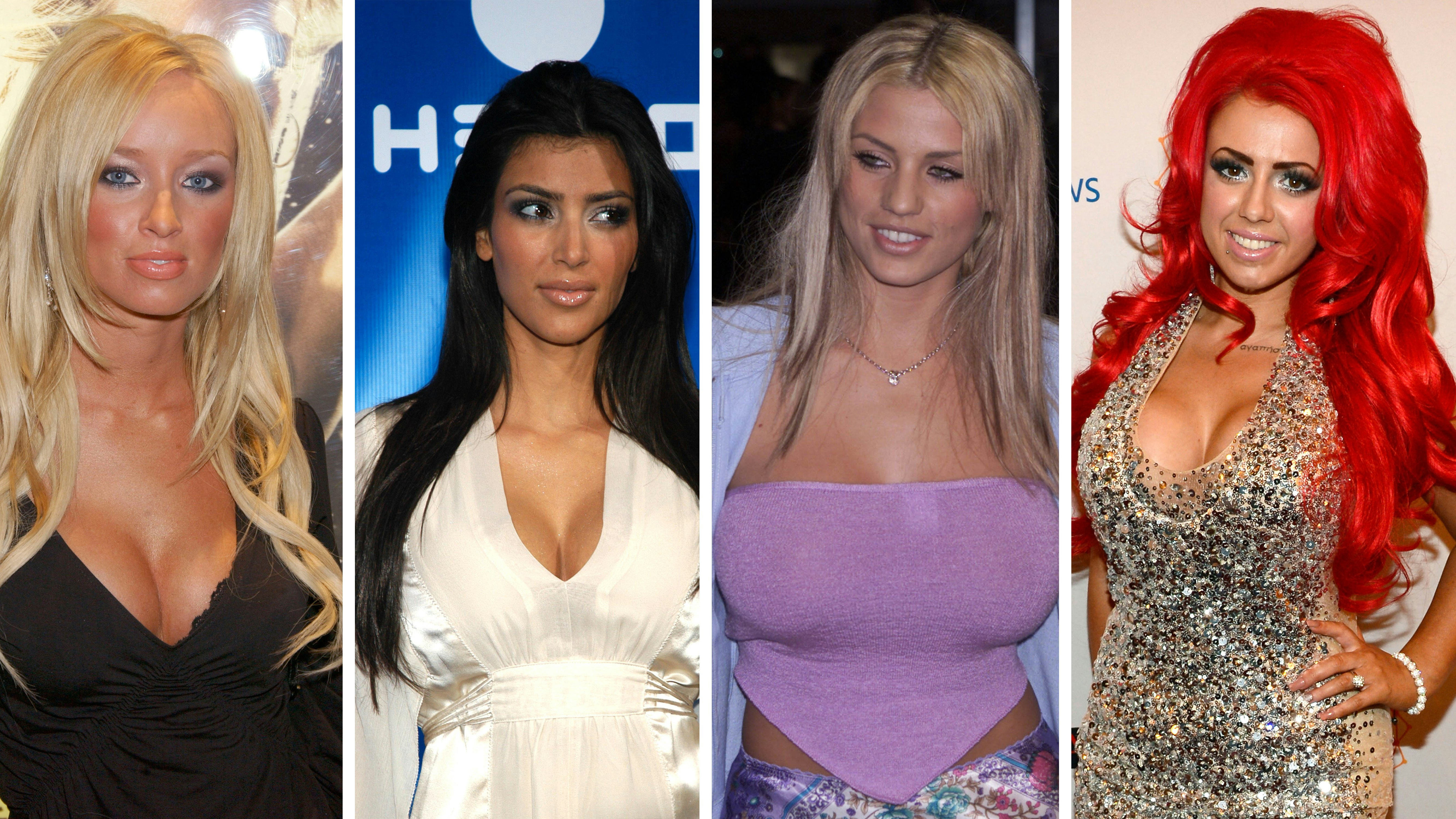 28 celebrities who look VERY different after plastic surgery