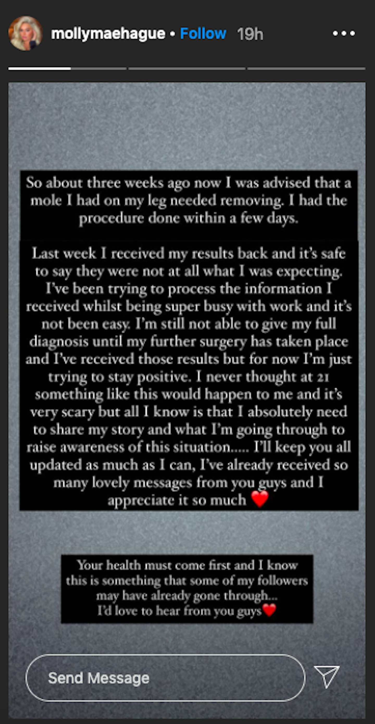Molly-Mae Hague diagnosis