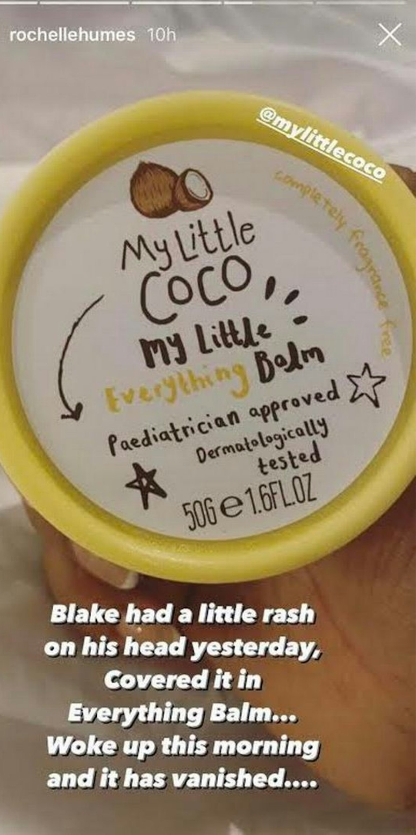 Rochelle Humes shares magic baby balm with followers