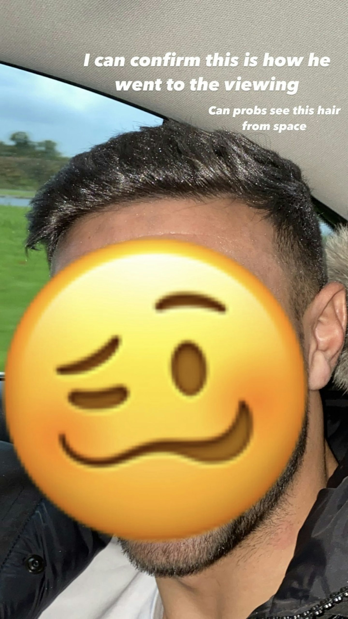 Tommy Fury green hair transformation