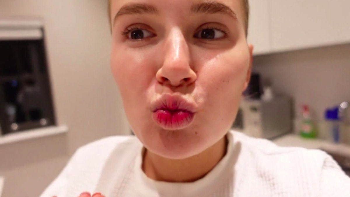 Molly Mae Hague Debuts Natural Lips After Getting Filler Dissolved Celebrity Heatworld 