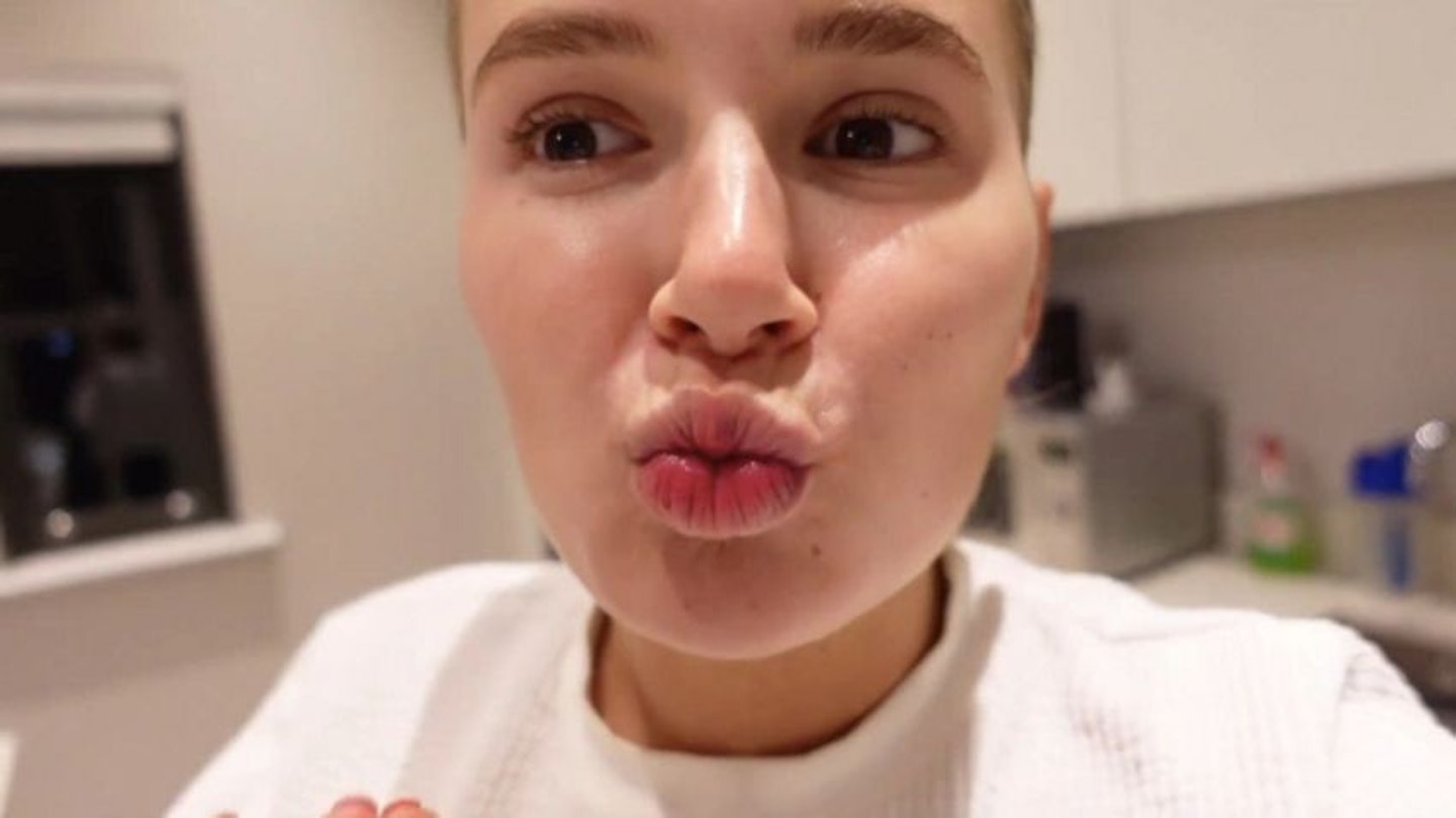 molly mae hague shows off lips after dissolving filler