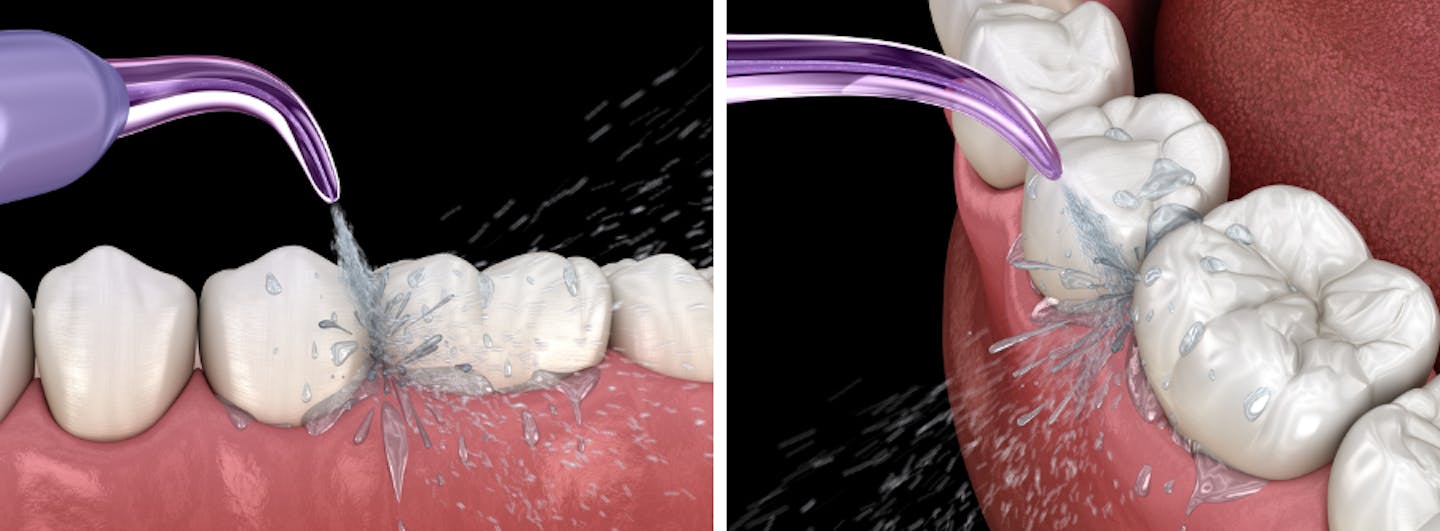 The Best Water Flossers For Better Oral Hygiene Wellbeing Yours The Best Water Flossers For Better Oral Hygiene Wellbeing Yours