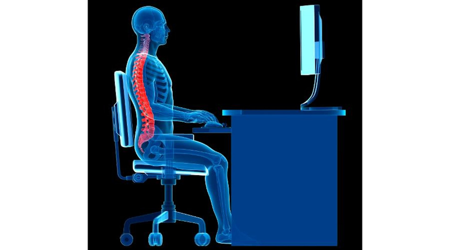 Spine xray of best posture