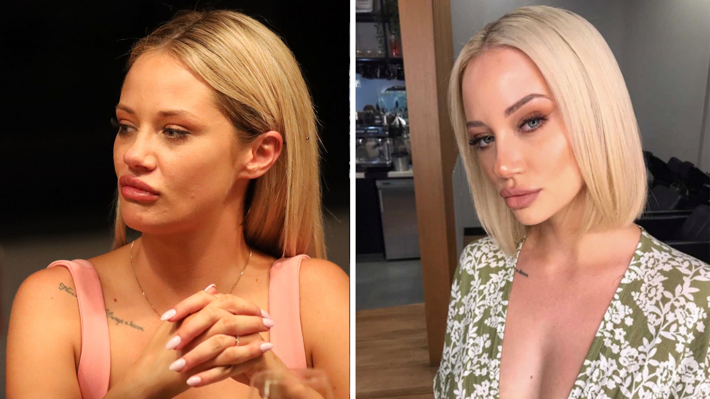 jessika power before after surgery