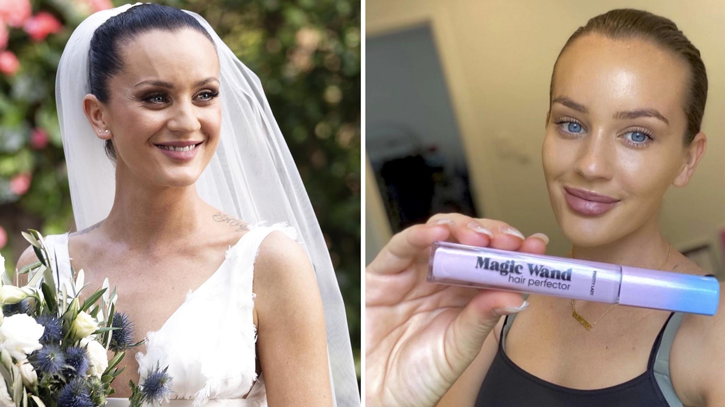 ines basic before after surgery