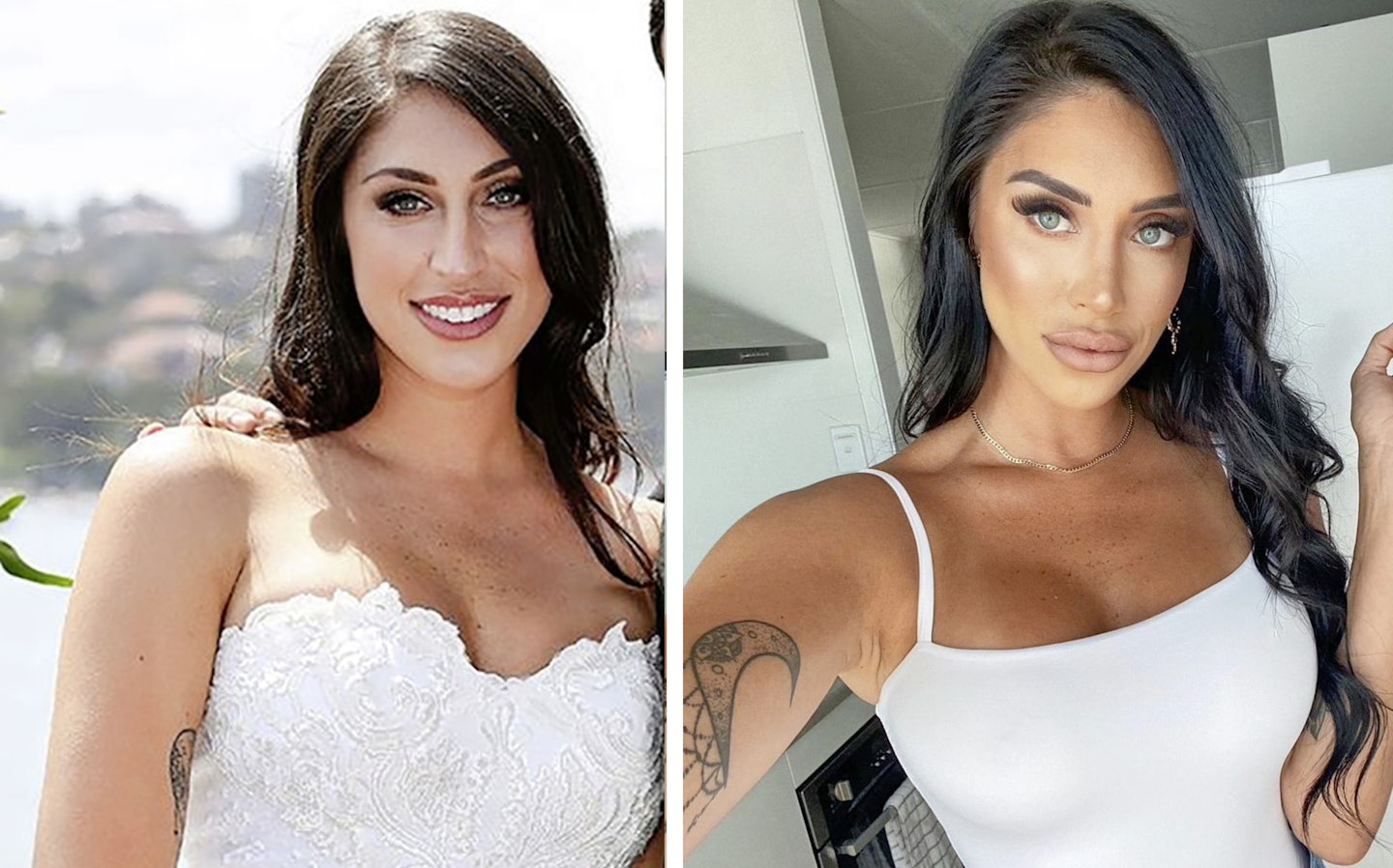 married at first sight tamara before after surgery