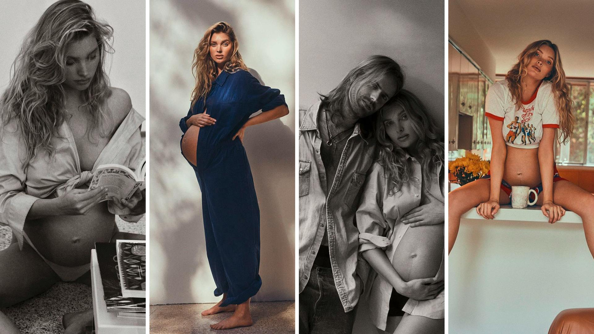 Elsa Hosk Should Be Applauded For Her Birth Honesty
