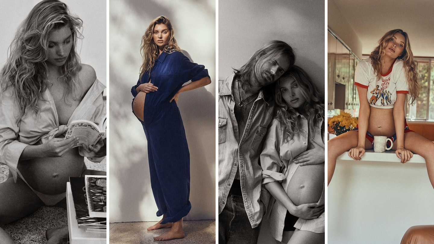 Elsa Hosk Should Be Applauded For Her Birth Honesty