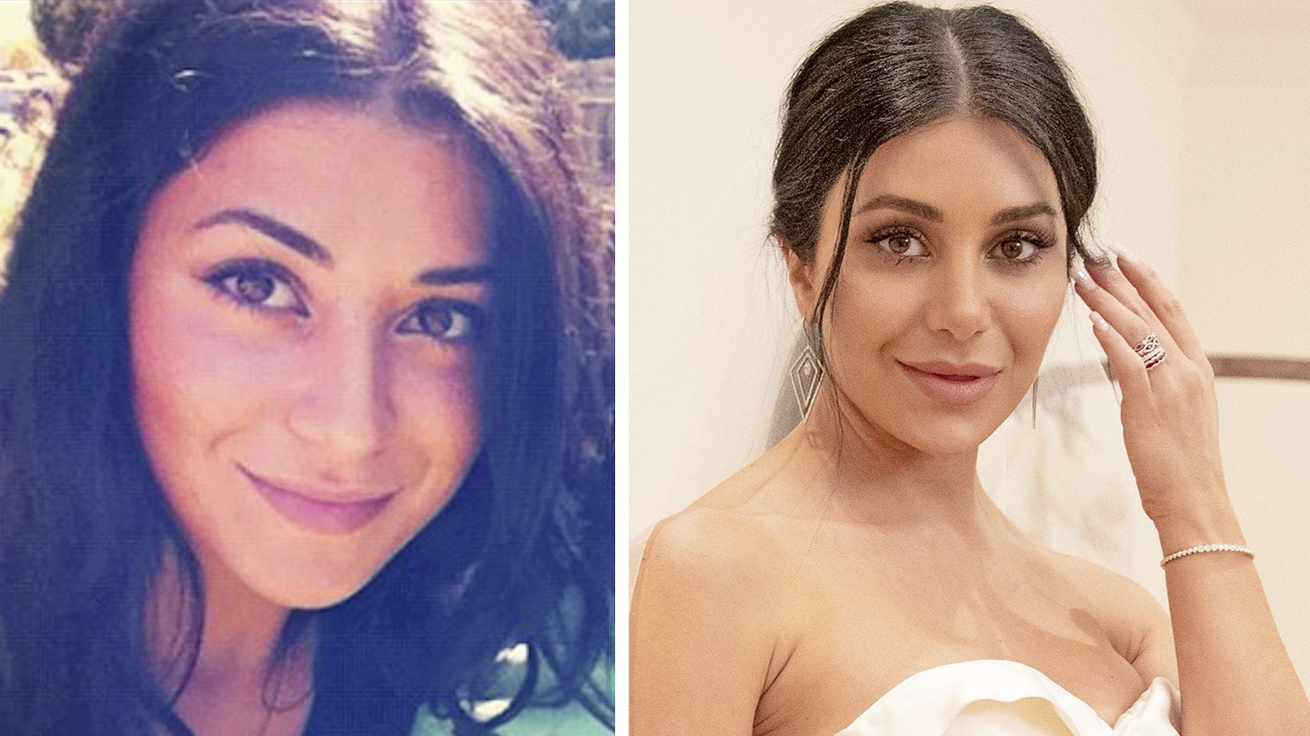 married at first sight australia martha Kalifatidis before after