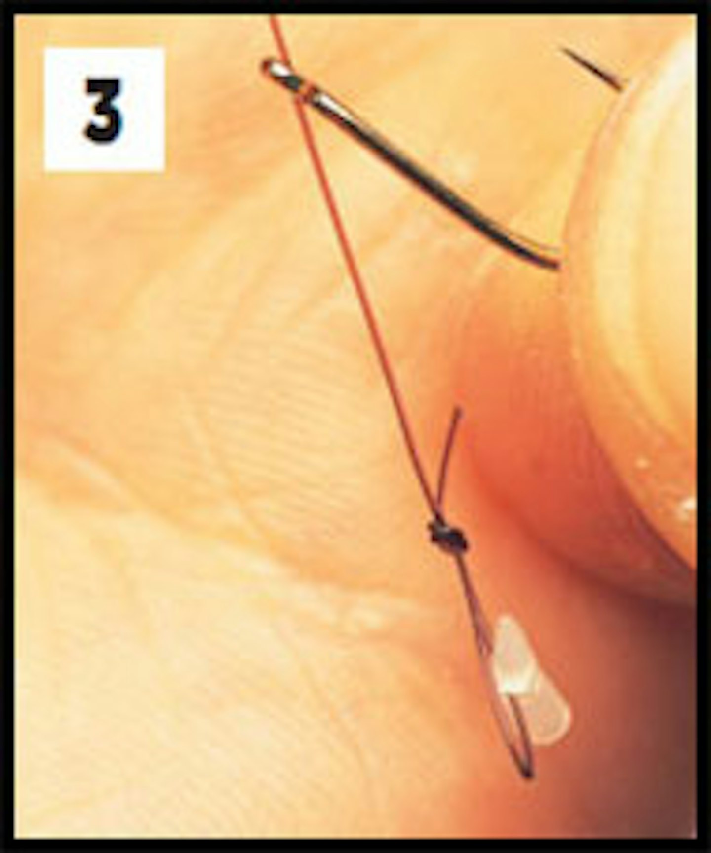 Thread the hooklink through the back of the hook eye.