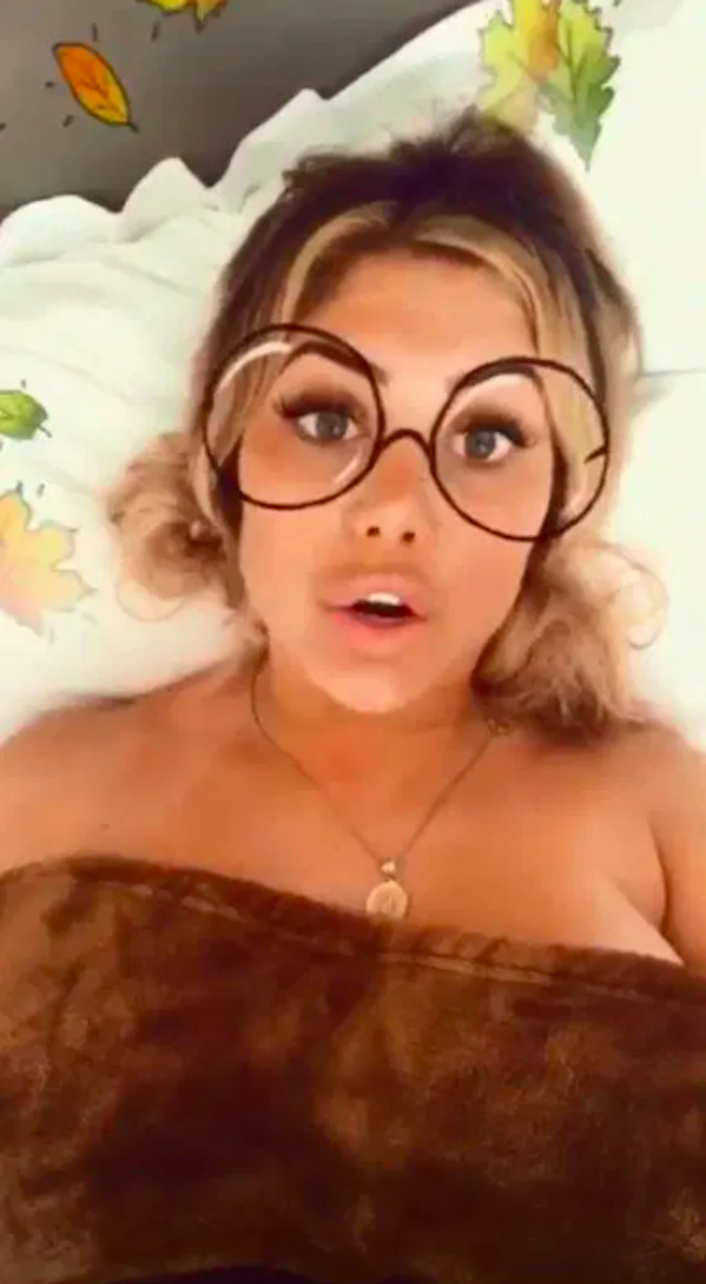 Chloe Ferry nose job