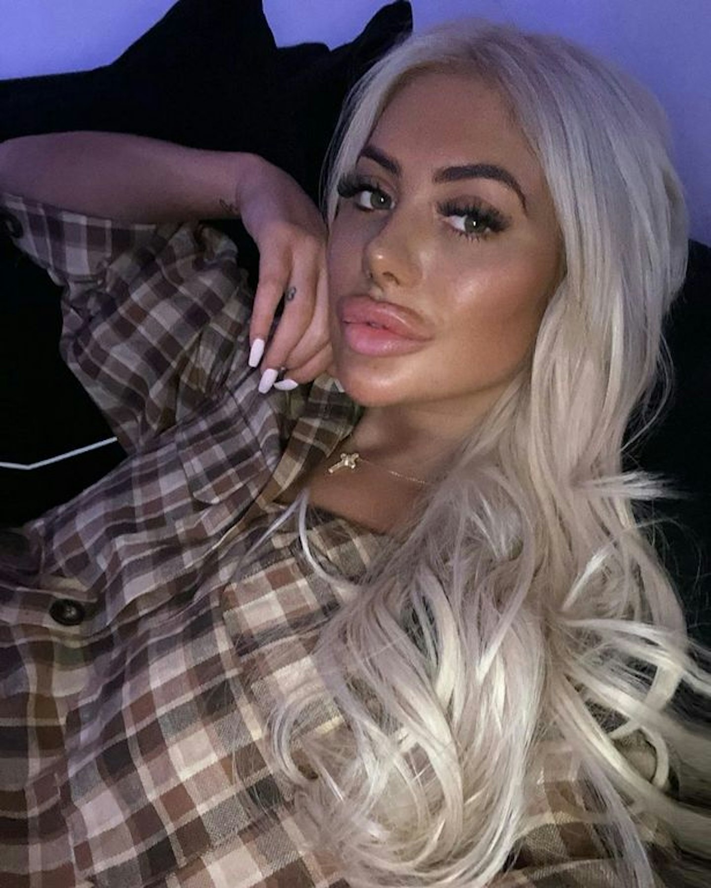 Chloe Ferry lip fillers