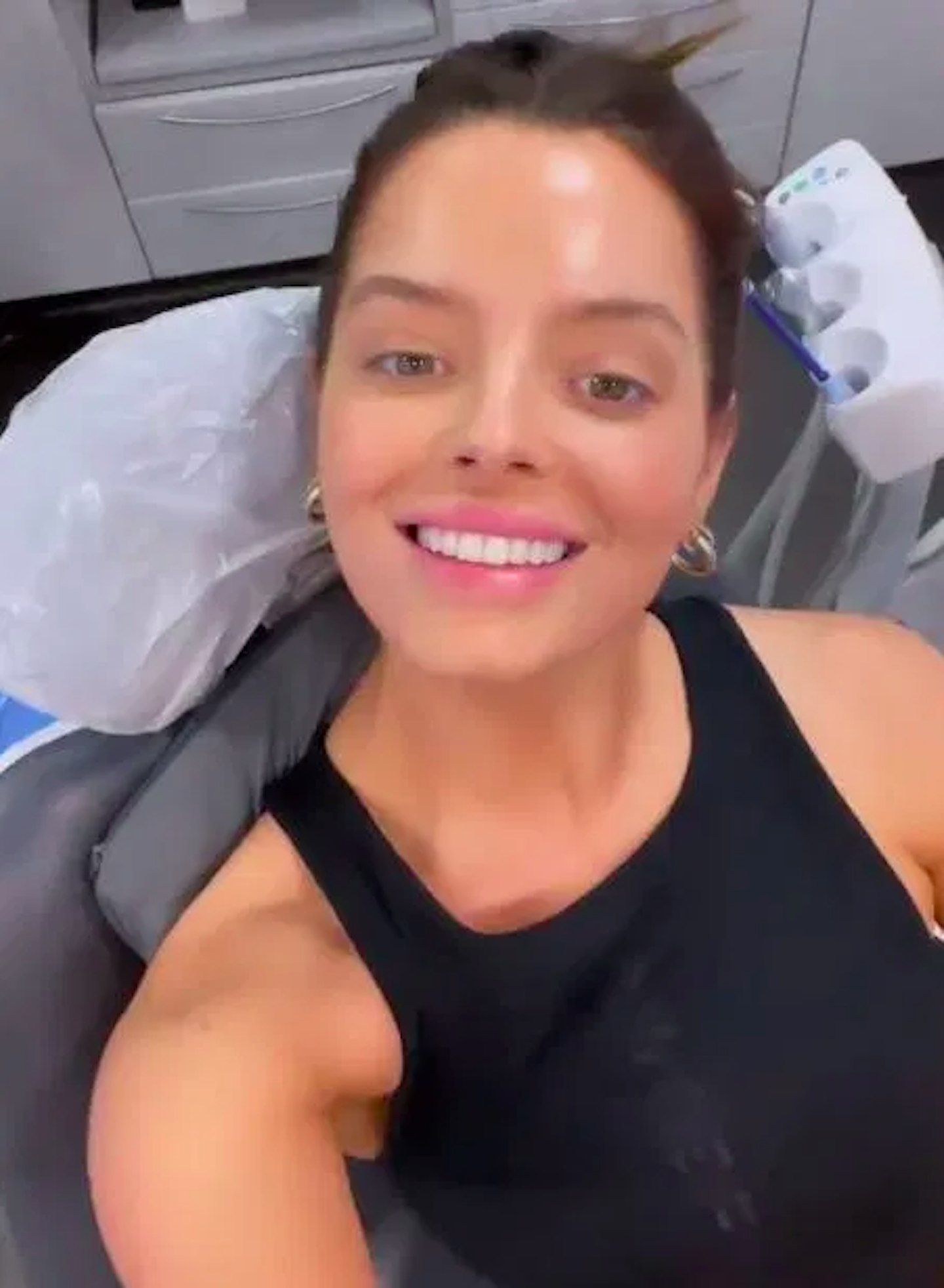Maura Higgins teeth transformation