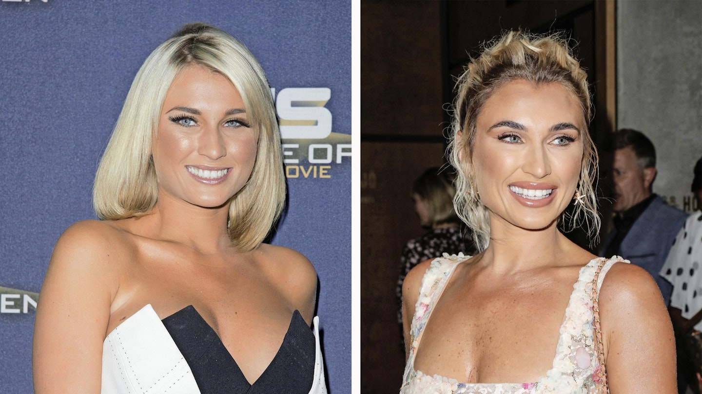 billie faiers before and after