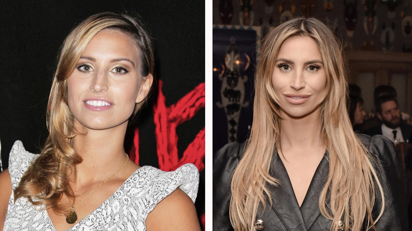 towie ferne mccann before after