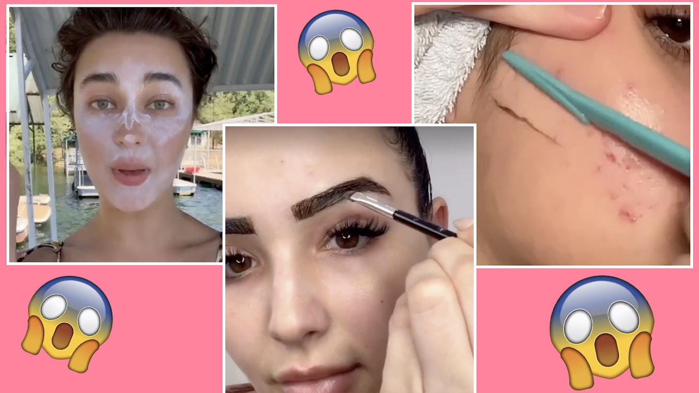 The anti-wrinkle straw is TikTok's latest viral trend - Cosmetic