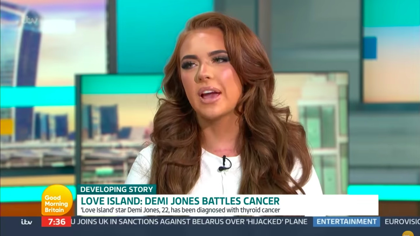 Demi Jones cancer lying Good Morning Britain