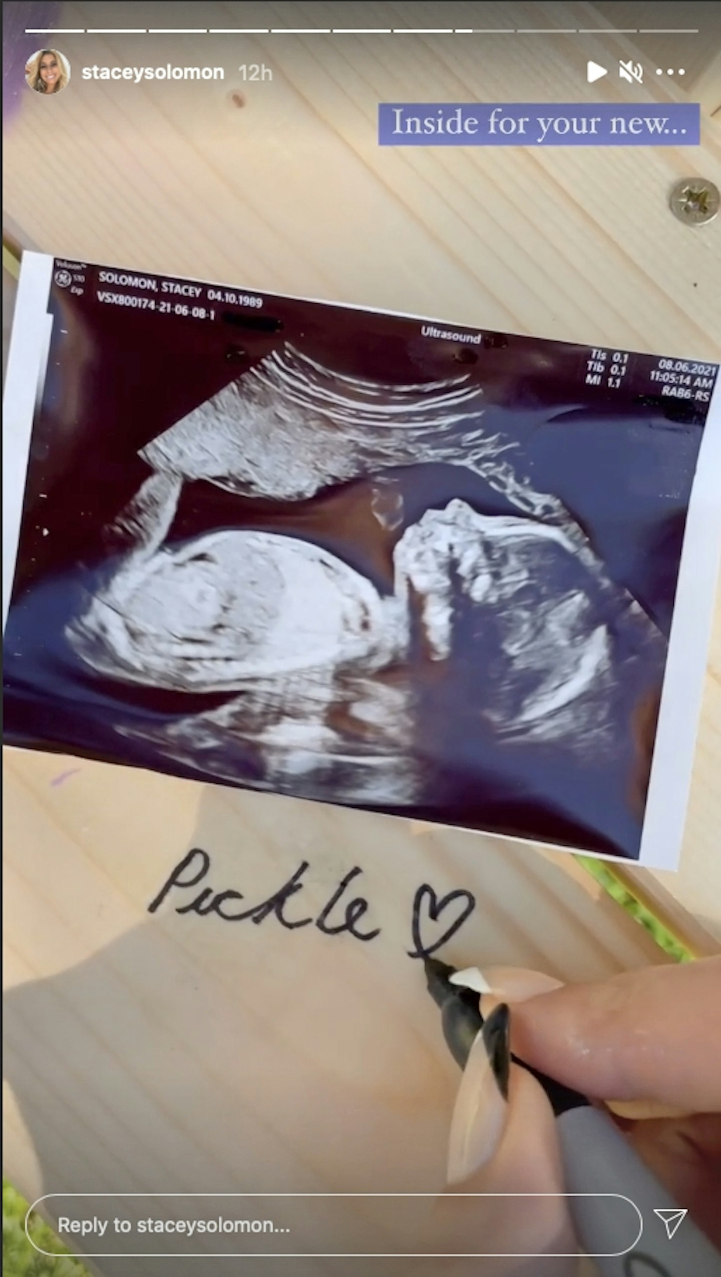 stacey solomon baby scan