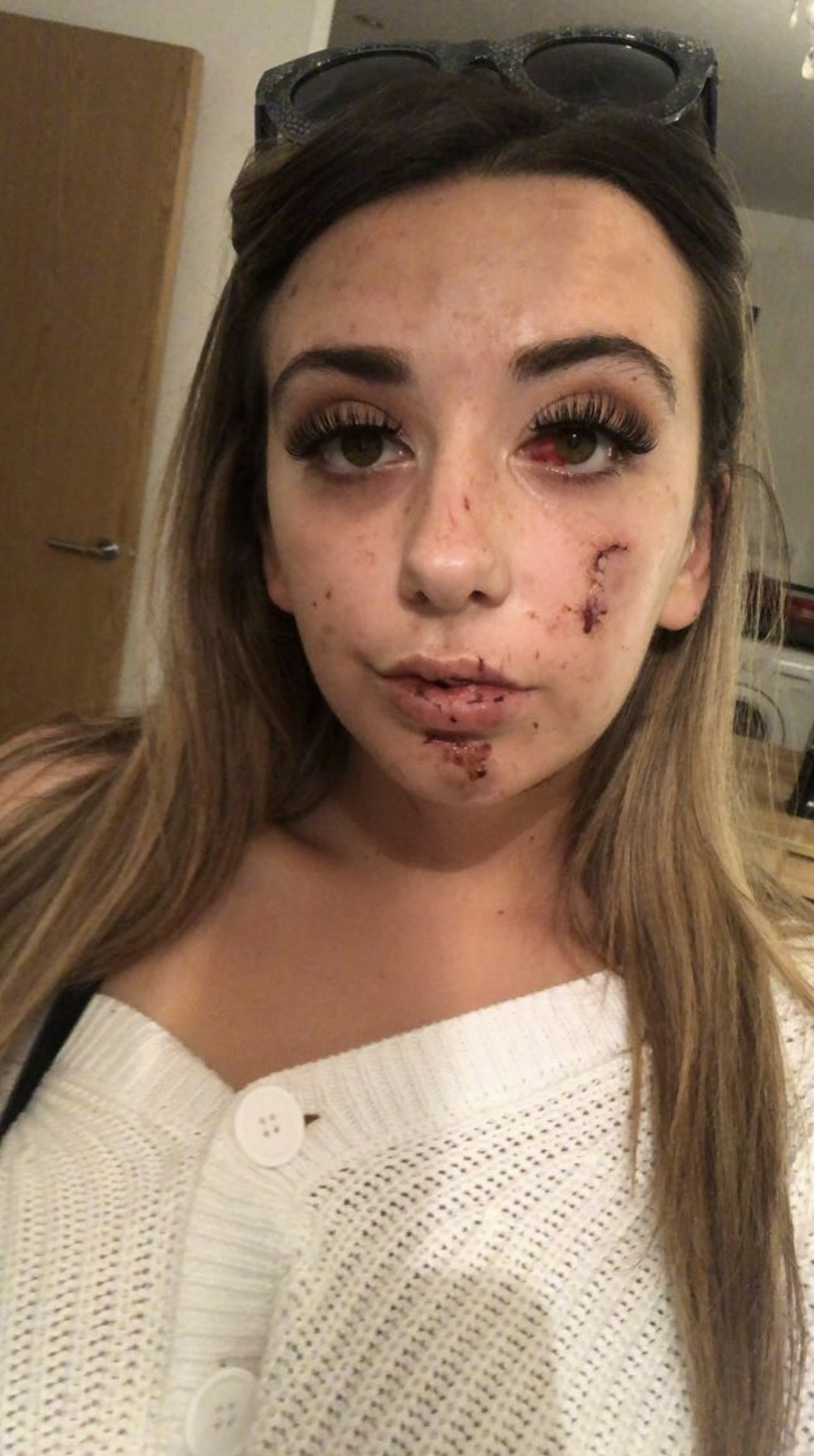 Good deed left me with 350 STITCHES